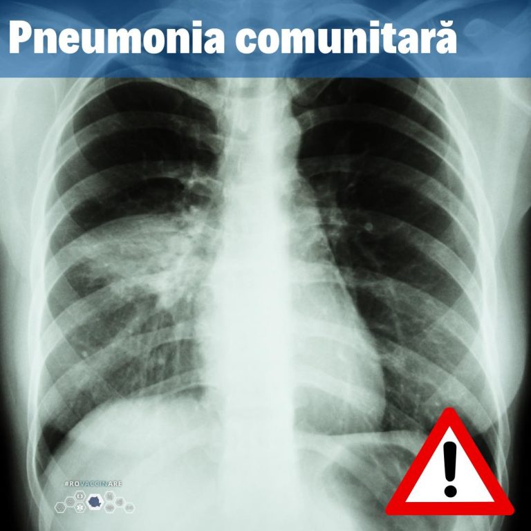 Creștere accentuată a cazurilor de pneumonii comunitare în ultimele zile în țară